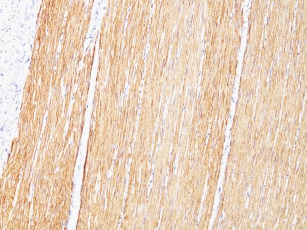 Desmin (Muscle Cell Marker) Antibody / Mouse Monoclonal Antibody [Clone D33] Catalog No Format Size