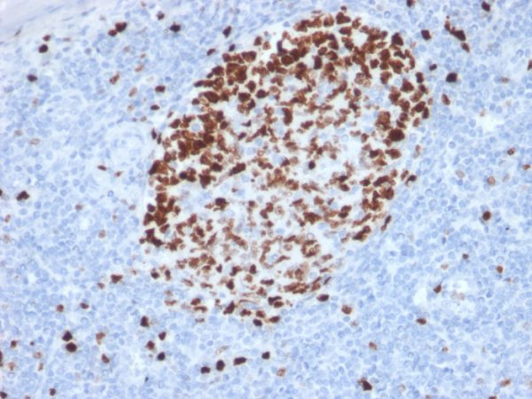 Ki-67 (Proliferating Cell Marker) Antibody/ Mouse Monoclonal Antibody [Clone MKI67/2462]